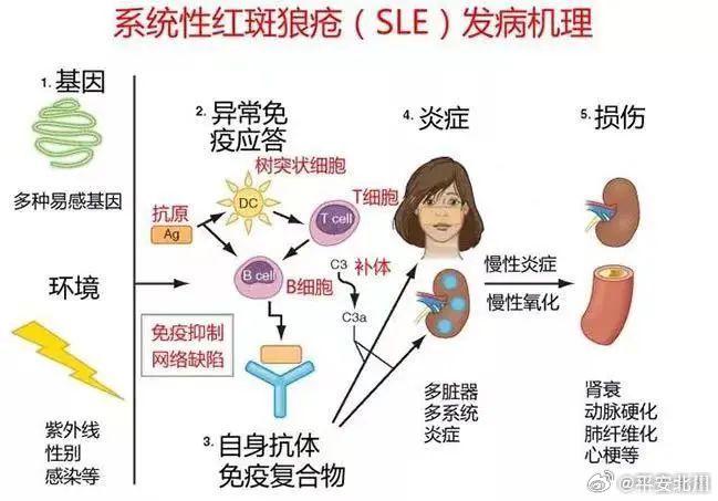 #红斑狼疮为什么是不死的癌症#