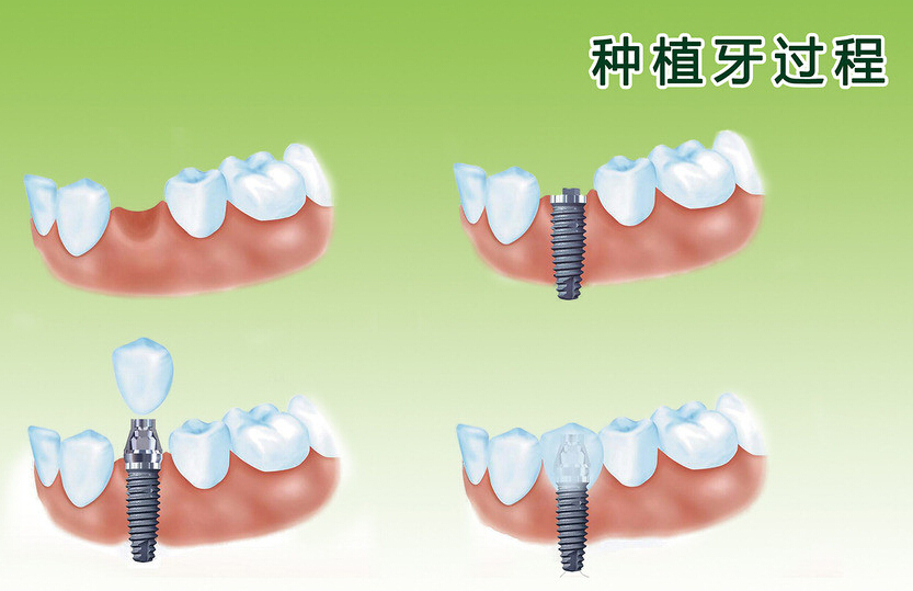 自动化焊接设备 第1036页