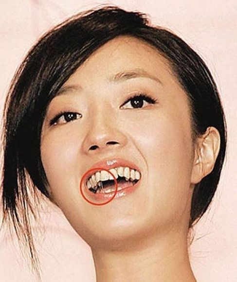 龅牙女明星，缺陷中的闪耀之美