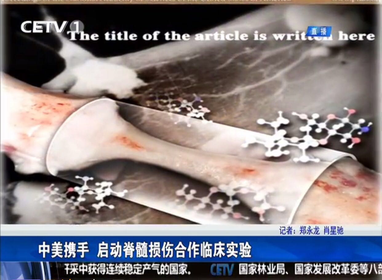 世界脊髓损伤最新突破，小巷深处的神秘小店助力康复之路