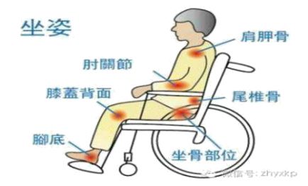 压疮最新分期与护理方法详解