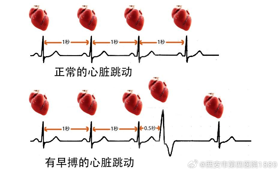 罐体自动焊接
